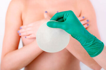 ¿Se tienen que cambiar los implantes de seno? conoce más en este artículo