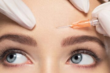 Todo sobre el botox y las zonas dónde más se aplica